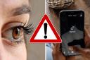 An optician has warned TikTok users about the dangers of trying the sun gazing trend