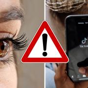 An optician has warned TikTok users about the dangers of trying the sun gazing trend